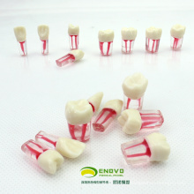VENDRE 12577 Dent Endodontique Endolorée Modèle de Dent 8pcs / set Endo dents